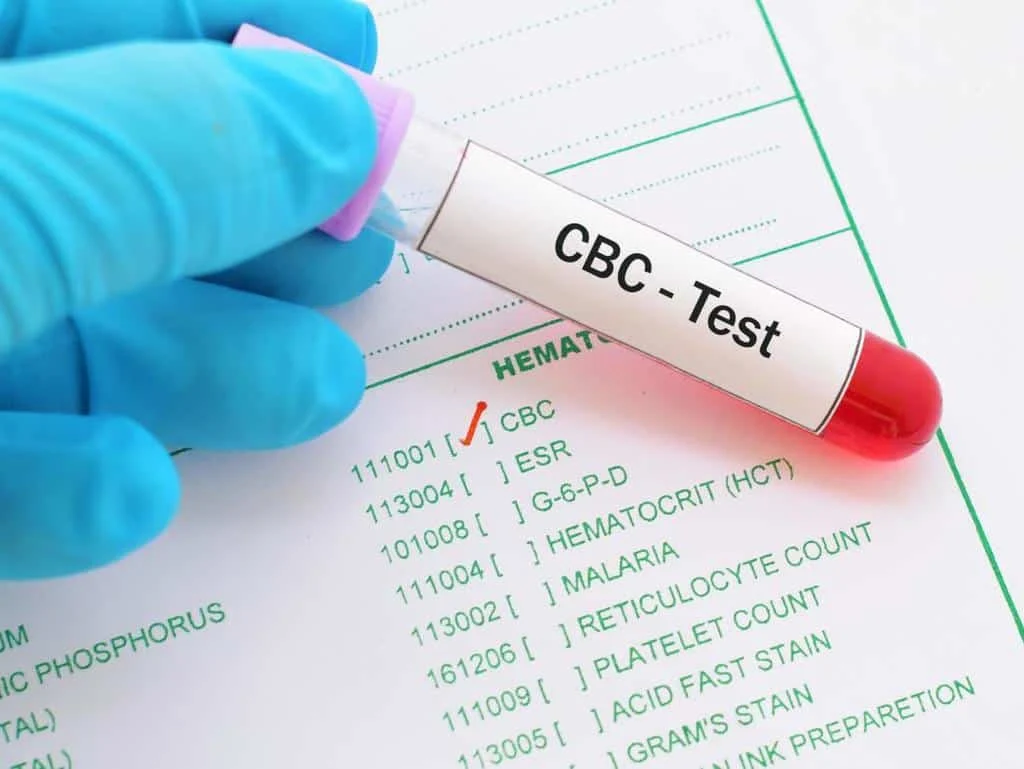 mchc در آزمایش خون + دلایل بالا و پایین بودن آن
