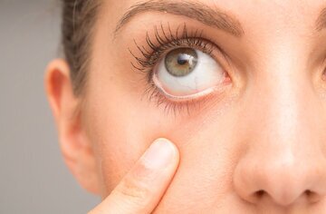 ردگیری کوچک شدن مغز از طریق چشم‌ها